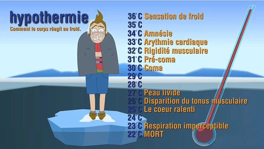 les stades de l'hypothermie